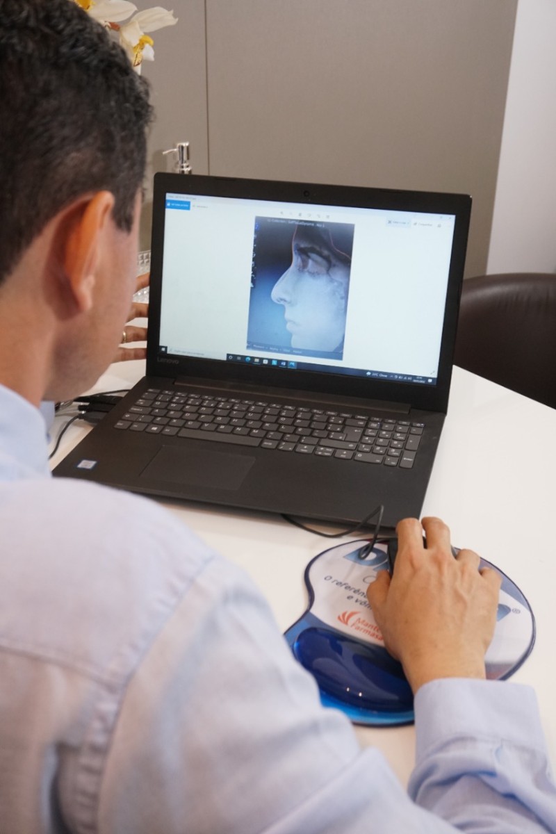 Rinoplastia é a segunda cirurgia plástica mais realizada por homens no Brasil