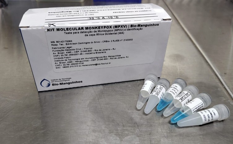 Lacen-TO passa a realizar testes para diagnóstico laboratorial do vírus Monkeypox