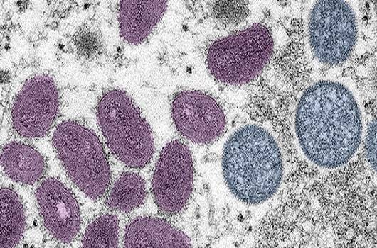 Saúde notifica quatro casos suspeitos de monkeypox no Acre