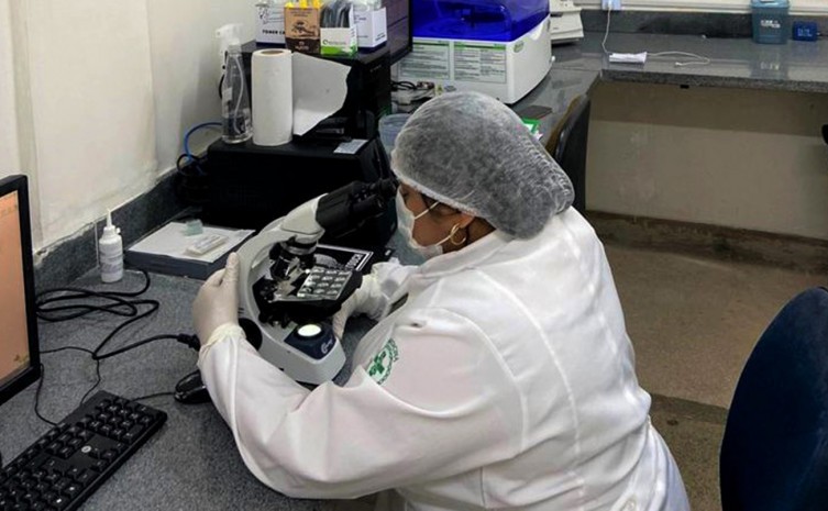 Governo do Tocantins amplia serviços laboratoriais dos hospitais estaduais