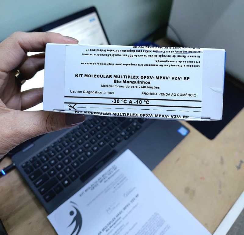 Lacen começa a realizar exames para detectar a Mpox