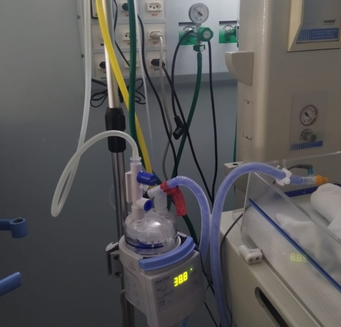 Terapia de Alto Fluxo reduz necessidade de intubação e de leito de UTI no Hospital Infantil de Florianópolis