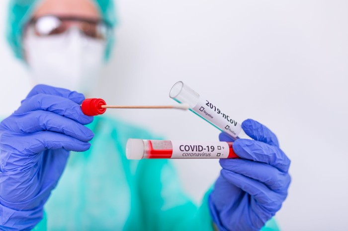 Casos de Covid-19 continuam em queda no Piauí e média móvel de mortes se mantém em estabilidade